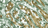micrograph of Avian influenza A H5N1