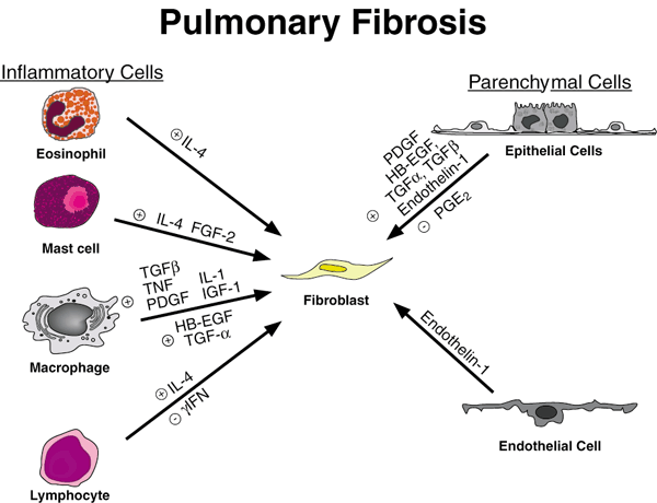 Inflammatory cells and mediators, effects on  fibroblasts