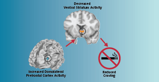 Scans showing effects of craving regulation in the brain