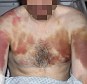 Horrific: This picture shows the injuries sustained by David Busby, a vulnerable man with learning disabilities, after he was bullied, tortured and humiliated by a bigoted couple