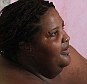 Food addiction: Doctors say at 625lb Dominique Lanoise may have less than a year to live 