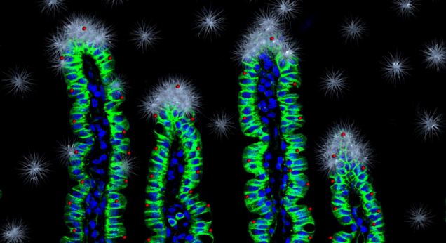 The amazing image was captured by Alexander Greenhough and Paloma Orduez Morn from the University of Bristol who are researching the development of colorectal cancer.