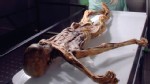 PHOTO: German scientists are helping decode the genome of the 5,300-year-old Tyrolean iceman, found in 1991 in the Alps close to the border between Austria and Italy.