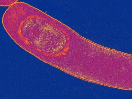 DNA sequences helped researchers trace the global travels of a drug-resistant superbug.