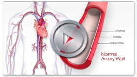 Interactive Cardiovascular Library Thumbnail image