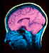 MRI of a human brain  