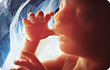 20-week old fetus in utero