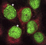 Asterisks highlight solid green PCNA protein that accumulates in cells with a lack of the enzyme ATAD5. The accumulation of protein occurs during stalled DNA replication.