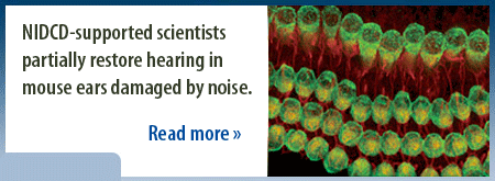 NIDCD-supported scientists partially restore hearing in mouse ears damaged by noise.