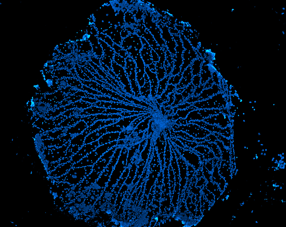 microscopic image of a network of blood vessels