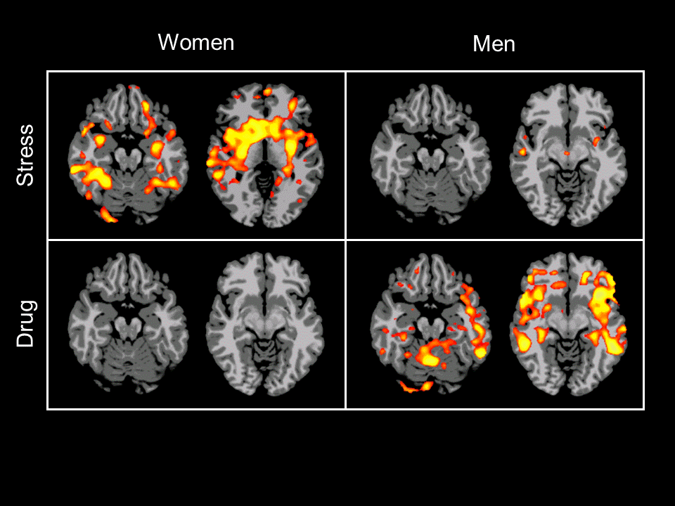 male and female brain scans