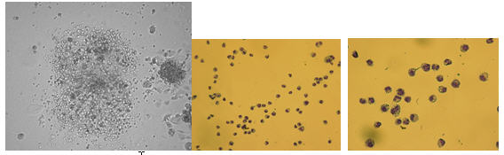 Images of Hematopoietic Colonies In Methylcelluose Colonies, MAC/MONO – 10X - Image 2
