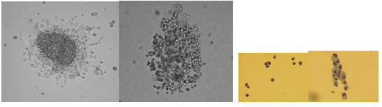 Images of Hematopoietic Colonies In Methylcelluose Colonies, MACROPHAGE – 10X - Image 1