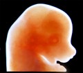 Craniofacial region of mouse embryo