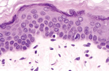 Image of melanocytes