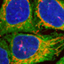 Confocal micrograph of several cells.