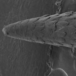 Microscopic image of porcupine quill. Credit: Jeffrey Karp and Woo Kyung Cho, Brigham and Women's Hospital.