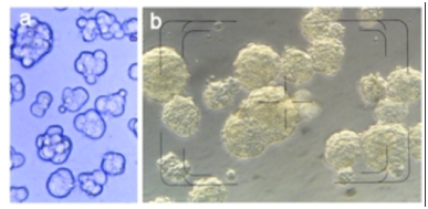 Early phase neurosphere formation (a) and high density neurosphere culture (b), phase contrast microscopy