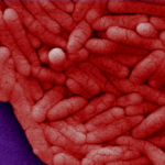 Salmonella typhi_Credit CDC