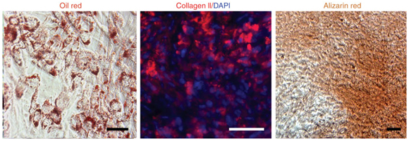 Figure 9: Adipogenic, chondrogenic and osteogenic differentiation of myofibroblast cells derived from hESC-NC cells.