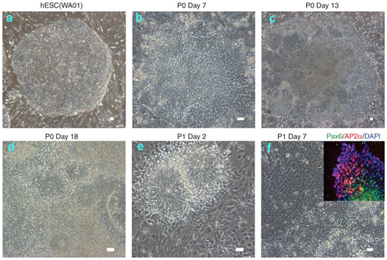 Procedures for isolating hESC-derived neural crest cells with MS5 coculture