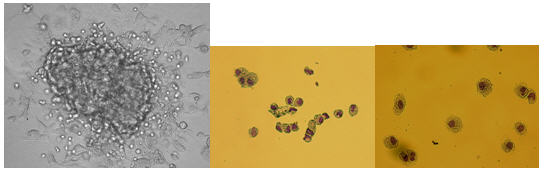 Images of Hematopoietic Colonies In Methylcelluose Colonies, MACROPHAGE – 20X