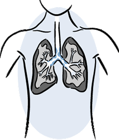Cartoon of lungs with mucus.
