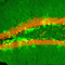 Newborn neurons in mouse hippocampus