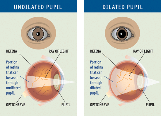 The Dilated eye