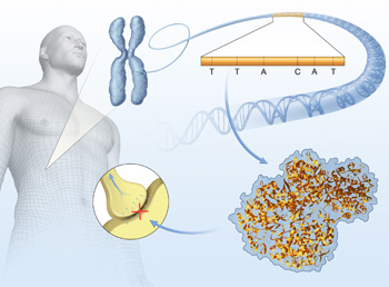 A journal article illustration depicting genetic factors for bone pain