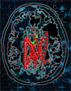 S1P1 receptor with target molecule. Image courtesy of Raymond Stevens, The Scripps Research Institute