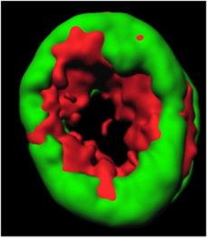 Caption: Phospho-HSP90a (red) co-localizes with gamma-H2AX (green) in the apoptotic ring where it plays an essential role in the completion of programmed cell death.
