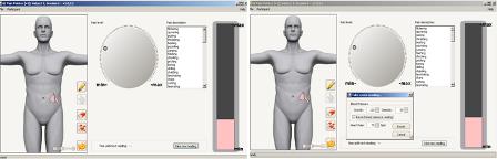 Image from GIPP device showing illustrated torso and pain pointer.