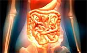 Patients Urged to Watch for Trouble After Colon Surgery