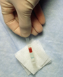 Blood cholesterol analysis - Copyright: Science Photo Library