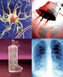 Advances in respiratory medicine - Copyright: Science Photo Library