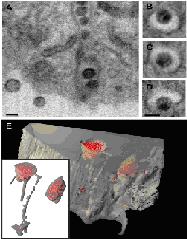 Electron Microscopy Sample