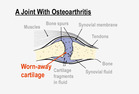 Joint with osteoarthritis. - Click to enlarge in new window.