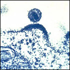 The virus that causes AIDS is shown budding out of a human immune cell, which the virus infects and uses to replicate.  