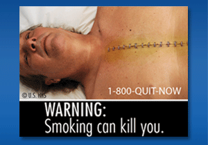 WARNING: Smoking can kill you. Image: Deceased man with surgical staples going down his chest.
Cessation Resource: 1-800-QUIT-NOW
Copyright: U.S. HHS