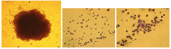 Images of Hematopoietic Colonies In Methylcelluose Colonies, ERY-MYELO – 10X
