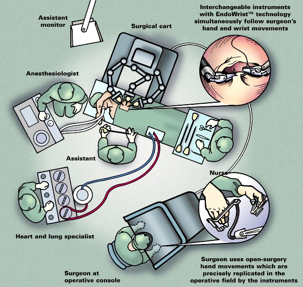 Schematic layout of operating room robotic prostate surgery/ Layout drawing of surgery suite from a bird's-eye perspective with positions of robot, screens, surgery table, instrument console, noted