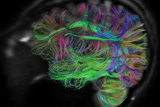 Mapping the Circuitry of the Brain