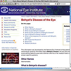 Behçet's  Disease of the Eye