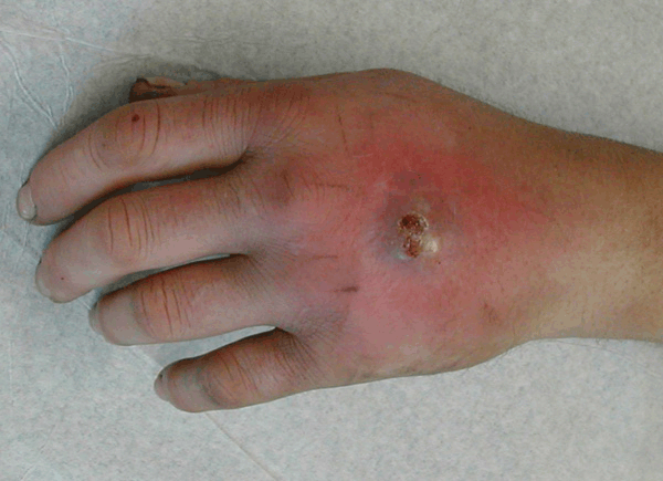 44-Year-Old Man with Physical Examination Abnormalities (Anterior View)