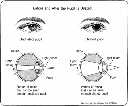 Diagram of the Eye Before and After Dilated Eye Exam.