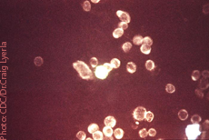 Fotomicrografía de cultivo celular del herpes