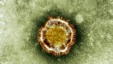Electron microscope image of a coronavirus, part of a family of viruses that cause ailments including the common cold and SARS (undated)