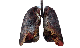 Diseased Lungs