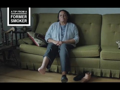 Marie talks about discovering she had Buerger’s disease, an illness caused by smoking, and its effects on her life in this video from CDC's Tips From Former Smokers campaign.